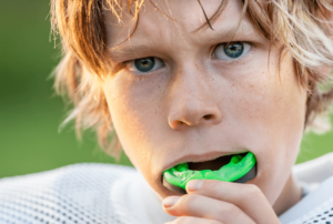 athletic mouth guards Prevention Dental Dentist in Boise Idaho