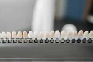 porcelain dental veneers veneer Prevention Dental Dentist in Boise Idaho